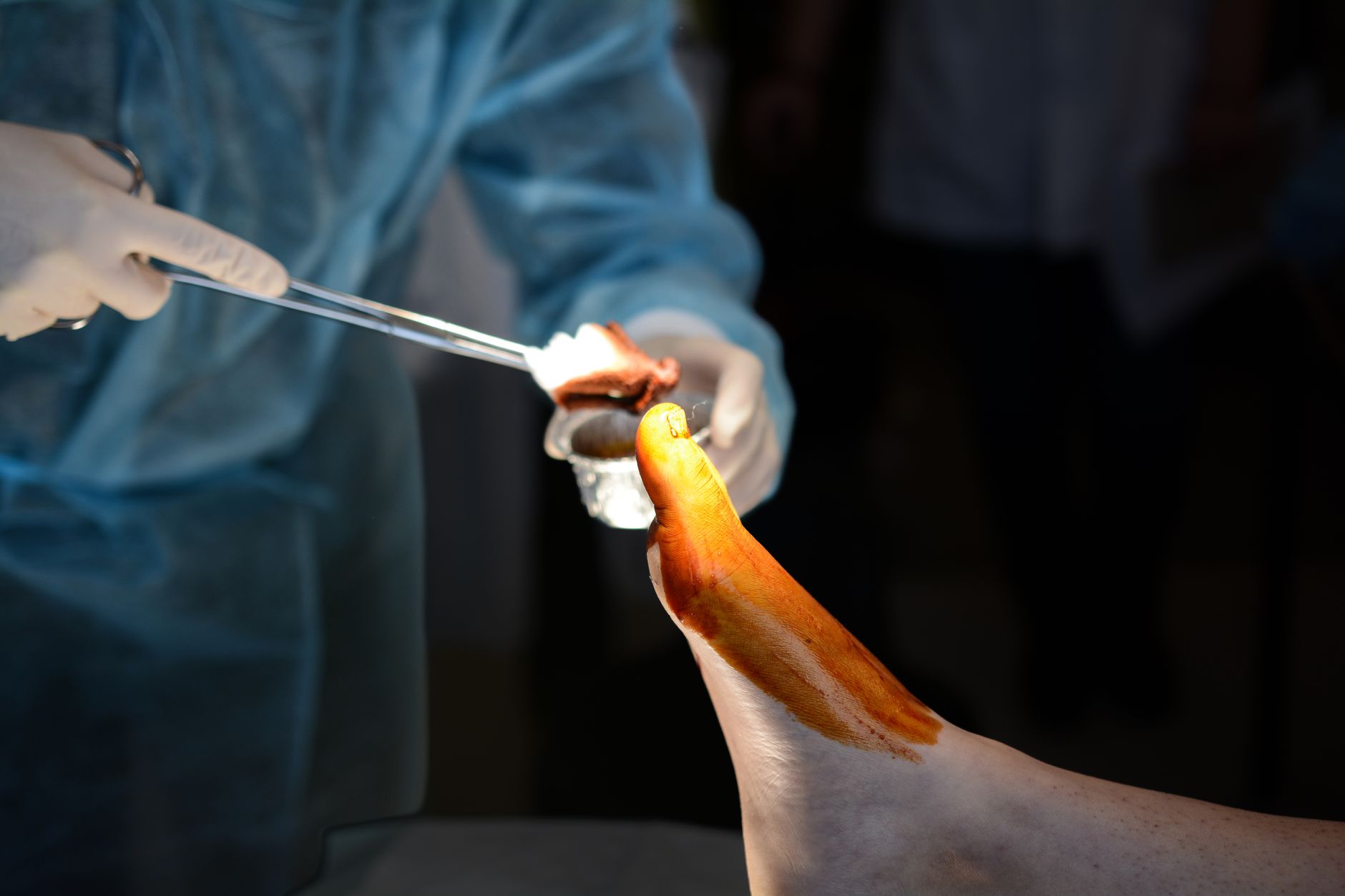 Surgical procedure on a patient's foot, highlighting medical precision and care.