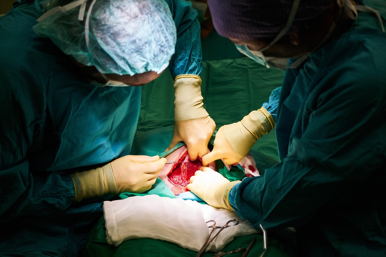 surgery, hospital, doctor, operation, nurse, teamwork, work, green, clinical, emergency, clean, hygiene, scissors, scalpel, mask, operating room, life, patient, hands, human, modern, medicine, surgeon, expert, anesthesia, skin